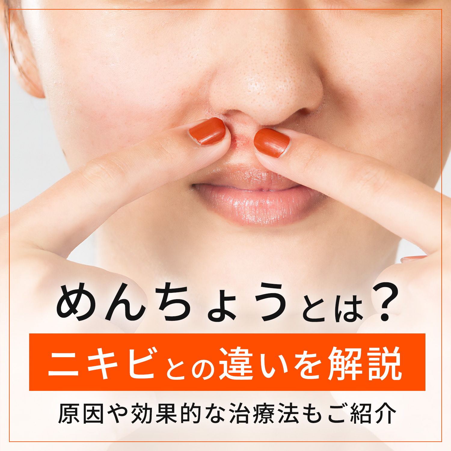 鼻のニキビが治りません。ニキビ・ニキビ跡の治療の治療方法・適応