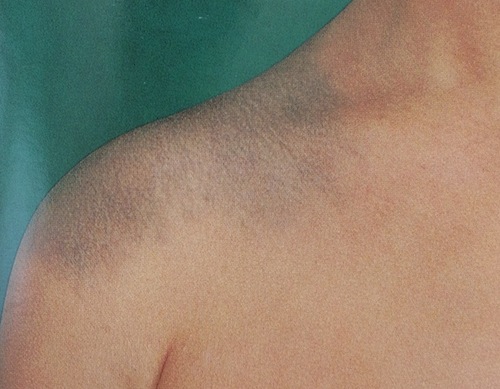 息子の異所性蒙古斑と葛藤して出した私なりの答え島根県安来市⋆*産前産後トータルケア整体Embrace~ｴﾝﾌﾞﾚｲｽ~♡