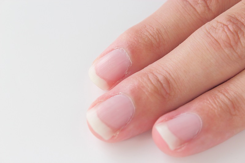 チアノーゼ」の546点のロイヤリティフリー画像、写真素材、絵Shutterstock