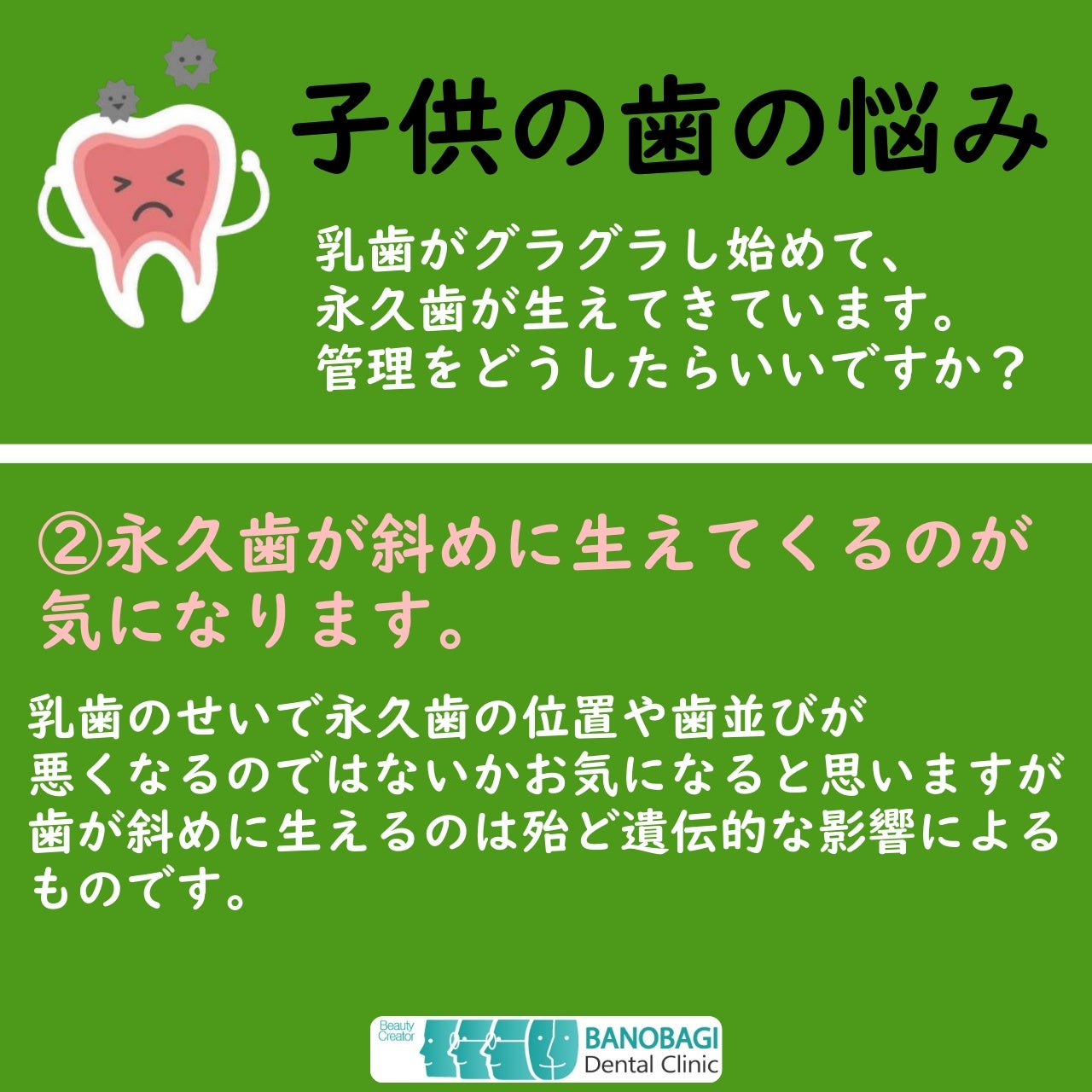 虫歯菌除去システム「3DS」 〜宇部で予防歯科なら石川歯科〜石川おとなこども歯科・矯正歯科宇部市 山口 の歯医者さん