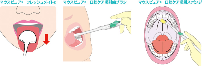 バイトブロックを使った口腔ケアのイラスト_開口のイラスト素材60987566- PIXTA