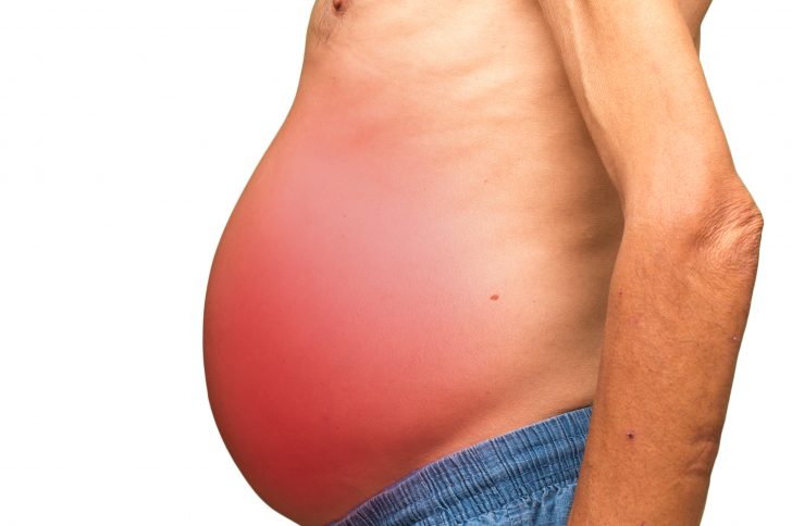 医師監修 アルコール性肝障害でよく見られる「腹水」の治療法とは？医師が作る医療情報メディア medicommi