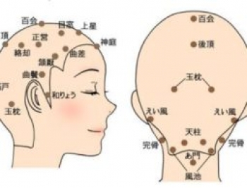 東洋医学的に頭痛を考えてみよう！頭痛に効くセルフケアツボもご紹介！ – 名古屋の女性専門美容鍼灸院アイリス治療院