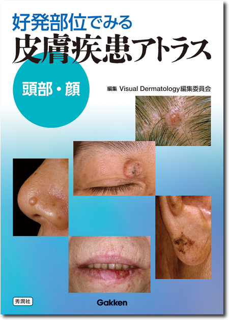 医学本 皮膚病診療 2022-1 診断に苦慮した症例 皮膚科 - メルカリ