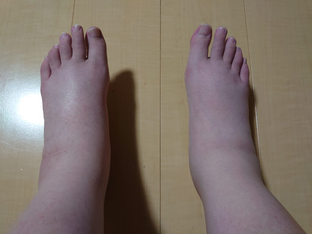 楽天市場 妊婦 足 の むくみ マッサージの通販