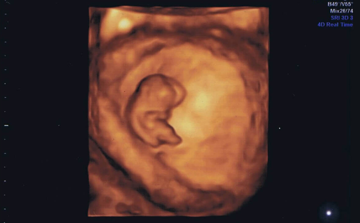妊娠37週 赤ちゃんのエコー写真・超音波写真まとめたまひよ