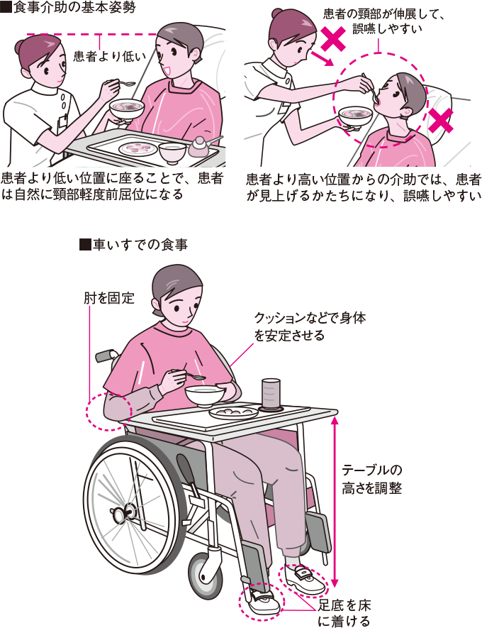 さあ始めてみよう！ 食事介助〜準備や実施のポイント、注意点〜ネスレ栄養ネット