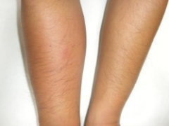 ハチに刺されたときの対処法 ミツバチ・アシナガバチ・スズメバチ- 福岡のネズミ・ゴキブリ駆除株式会社エム・トレード