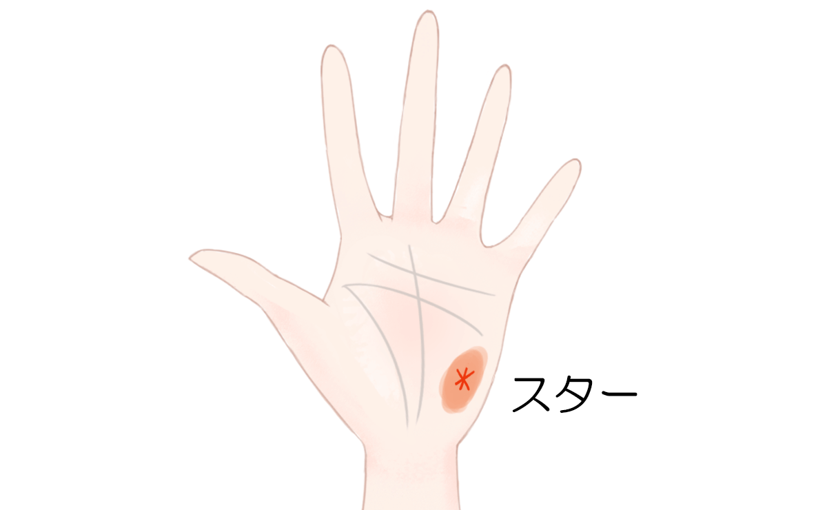 手相にスター 星紋 があるとラッキー？plush