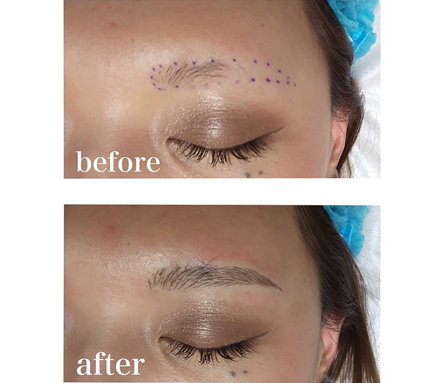 メンズアートメイクナチュラルアートメイク東京ブランクリニック