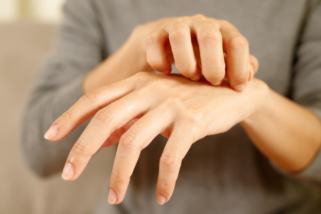 掌蹠膿疱症駒沢皮膚科クリニック世田谷区目黒区の皮膚科、形成外科、美容皮膚科駒沢大学駅直結