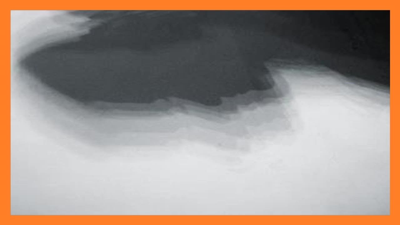 小野町子 自由🍉平和 on X: 