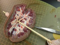 Amazon.co.jp: ヒト腎臓の3方向拡大解剖学的モデルは腎臓断面ネフロンと糸球体から成っています。副腎の解剖学的構造を含みます :産業・研究開発用品