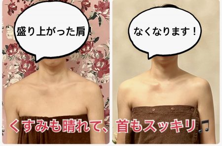 小顔矯正のプロが伝授！ 首を長く見せる メソッドを磯山さやかさんが試してみたら？美ST ONLINE