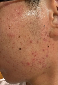 質問日時の新しい順 スキンケア 回答受付中の質問 - Yahoo!知恵袋