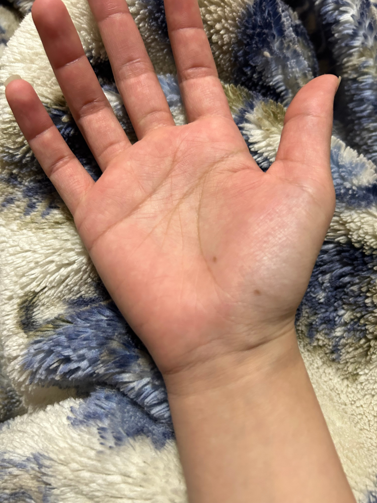 大林木手相 PalmReadingon X: 