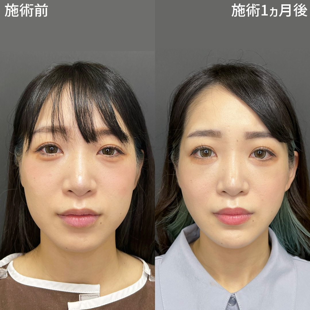 ボード「松田リマ 旧芸名は、片貝 樹 かたがい いつき 」のピン