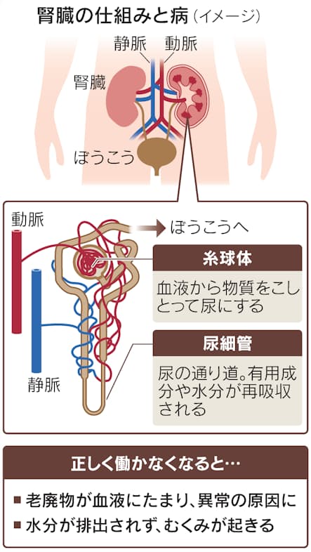 カビ多様 薬にも毒にも 紅麹サプリ健康被害：地域ニュース : 読売新聞