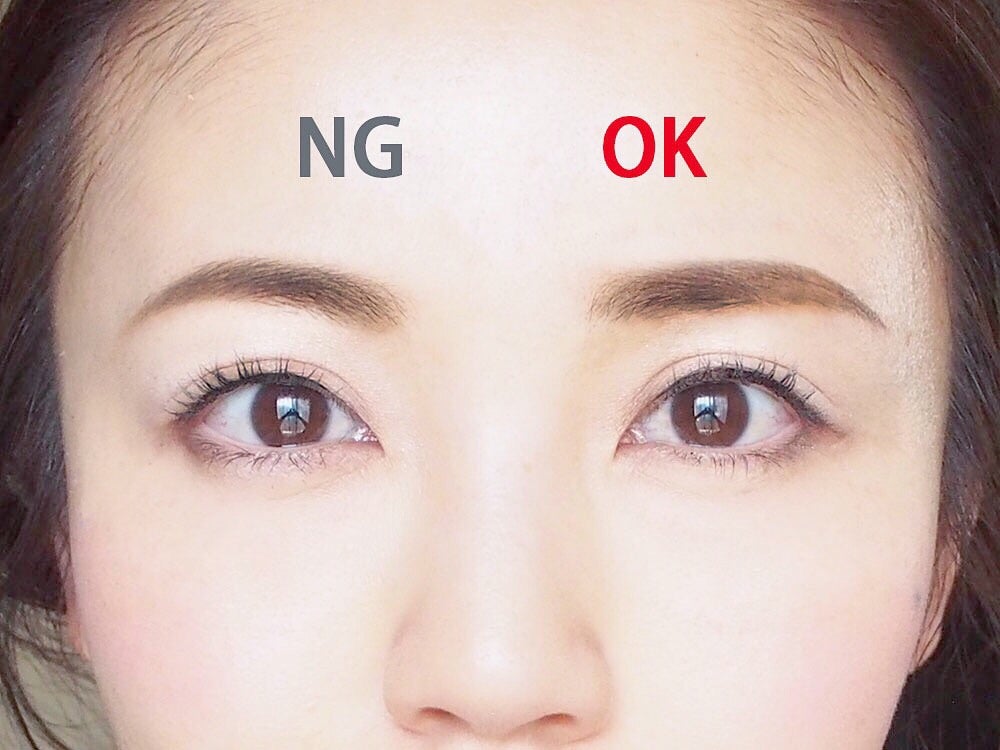 目が腫れぼったく見える原因ってなに？原因別解消法。日本を代表する美容健康再生医療のクリニックBIANCAGINZA