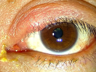 私は生まれつき三重まぶたです。線がたくさんありすぎて三重かも分かりません- Yahoo!知恵袋