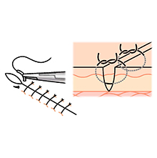 Amazon.co.jp: 小動物基礎臨床技術シリーズ 縫合法 : 左近允 巌, 古田 健介, EDUWARD Press編集部: 本