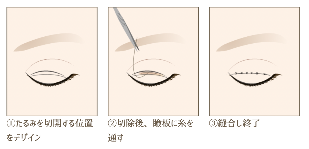 2023年 韓国クリニックで人気の美容整形ランキングTOP10！日本ユーザーはどれを選ぶ