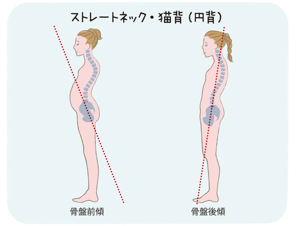 顔が前に出る姿勢を治す方法 3分で首を長くする- YouTube