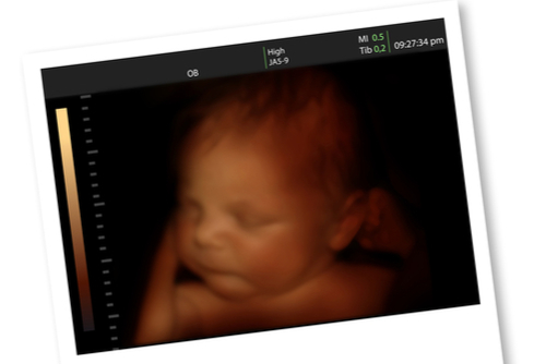 Amazon.co.jp: ダウンちゃんが我が家にやってきた！: ダウン症の赤ちゃんを授かった母親の出産記 電子書籍: 石川ひなの: Kindleストア