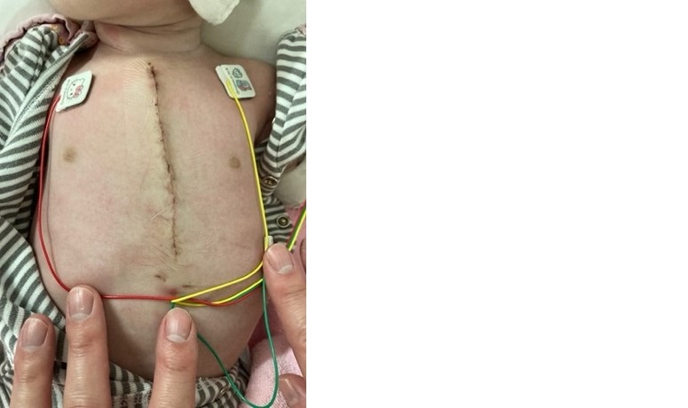 MICS 低侵襲心臓手術当院で行う治療・検査診療案内心臓病センター榊原病院