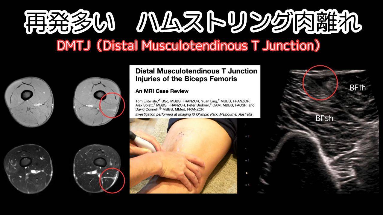 自宅でガッツリ鍛えれるハムストリング ３分間の時間制・自重トレーニング Hamstring workout
