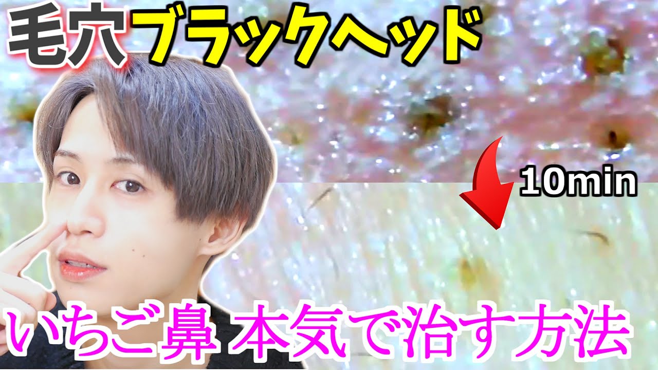 韓国でも話題に！ワセリンを使った「鼻の黒ずみ」ケアは本当に効果があるのか ？！ 比較写真あり- サランのコリア堂