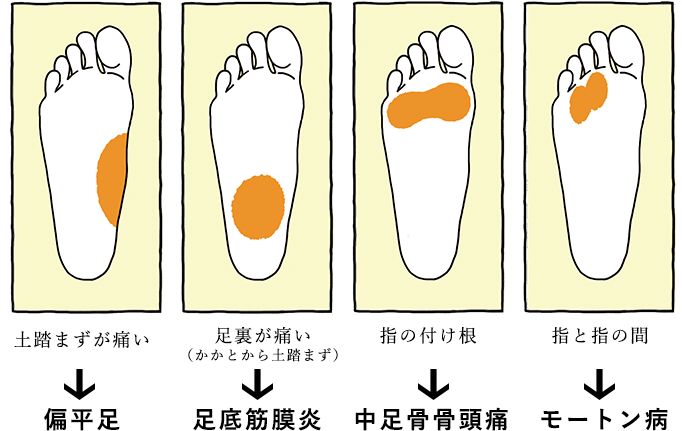 足つぼのゴリゴリは何が原因？ゴリゴリの正体や解消法を解説日本インストラクター技術協会 JIA