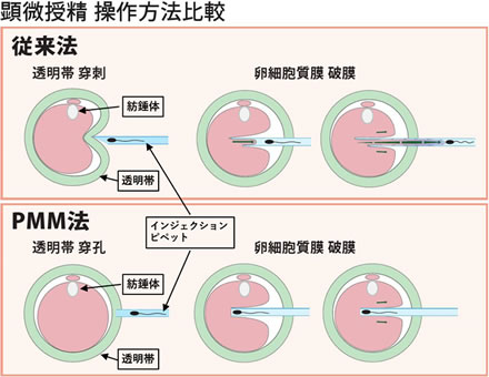 図解でわかる 初めての体外受精 IVF 対象の人や流れを詳しく解説にしたんARTクリニック
