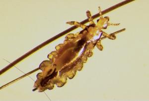 長い毛を持つプードルのペット犬にダニ、シラミ、ダニを使って薬をコントロールしている人」の動画素材 ロイヤリティフリー 1102912719Shutterstock