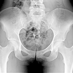 臀部痛の原因・症状・治療法を医師が解説│東京駅の整形外科 竹谷内医院 日本橋駅2分