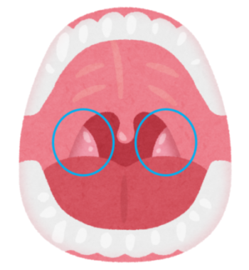 のどの病気と治療 - 仙台駅北口耳鼻咽喉科