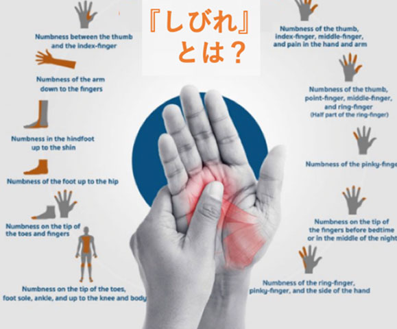 腕・手の痛みとしびれ 病状・病気について倉石整形外科クリニック 長野市若穂 リハビリテーション科