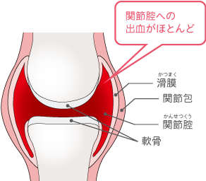 ぶつけてないのにあざができる原因は？主な病気と病院へ受診する際の目安を医師が解説皮膚のトラブル解決のための情報メディア-皮膚科Medi
