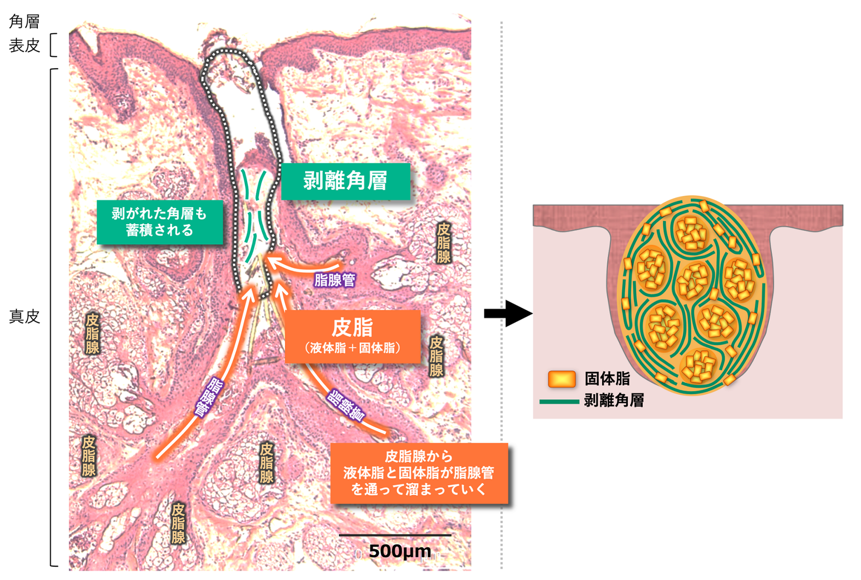 あごの角栓の原因や対策とは？ザラつきのないつるつる素肌になれる方法やおすすめアイテムを紹介！ONEcosme