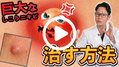 大きくてしこりのあるニキビはどう治す？粉瘤との違いって？ 皮膚科医監修- eo健康
