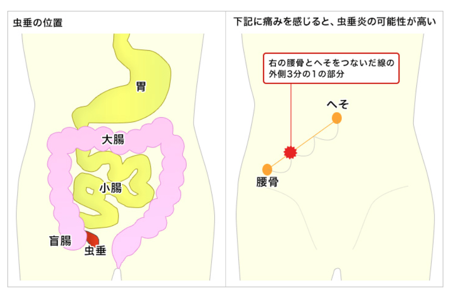 腹痛の部位おなかの悩み相談室大幸薬品株式会社