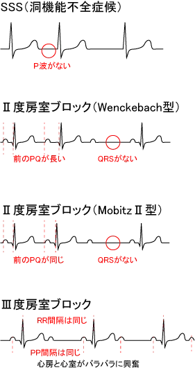 心電図異常ハートメディカルクリニックGeN 横浜綱島