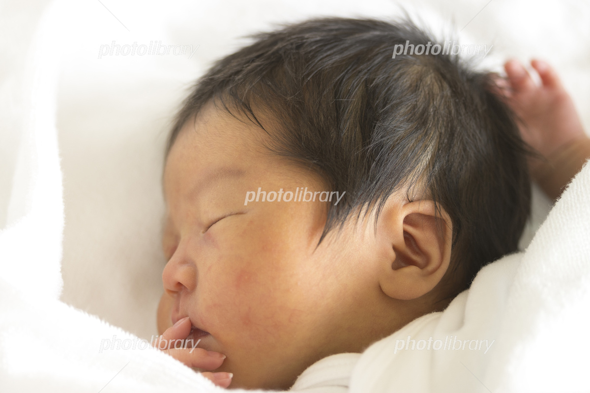 医師監修 赤ちゃんの黄疸の特徴と原因は？治療が必要なのはどんなとき？医師が作る医療情報メディア medicommi