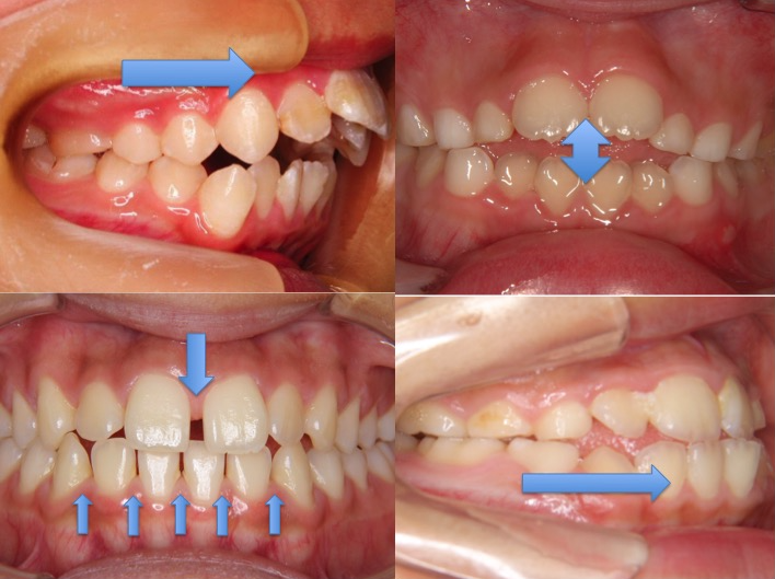 口に手を当てる人の心理とは？口元を隠す癖がある男女の本音を大公開Smartlog