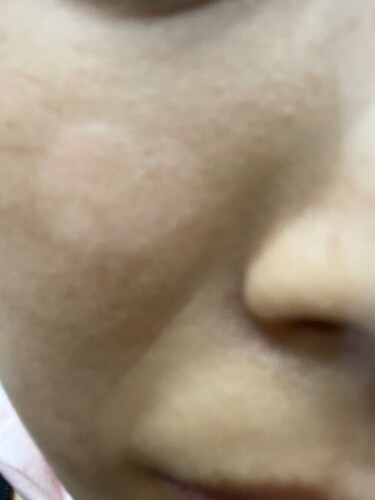 白斑武蔵小山皮フ科形成外科