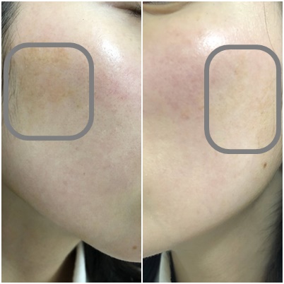 肌断食は目的があってやるべし。肌断食をする正しい目的とは？CHURA HADA