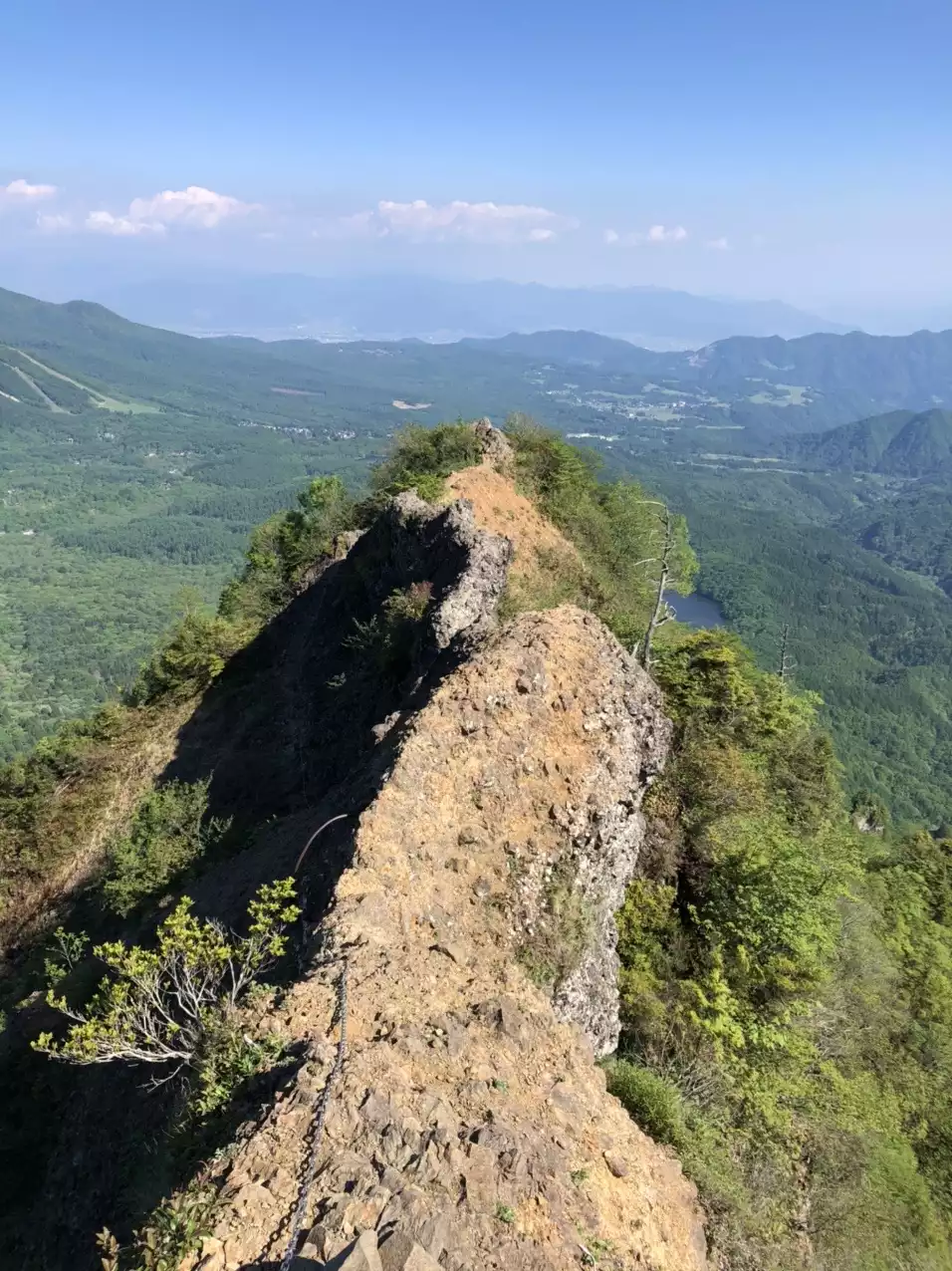 肛門周囲膿瘍│おしりオンライン武田薬品工業株式会社