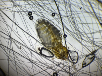 アタマジラミについて 豊中市