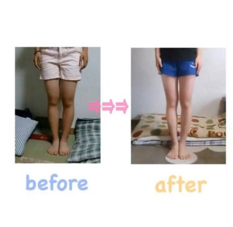 足の生えた大根の写真・画像素材-Snapmart スナップマート