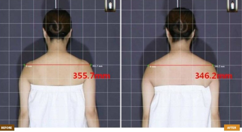 172.リフォームの話 その弐服部 晋の「仕立屋日記」